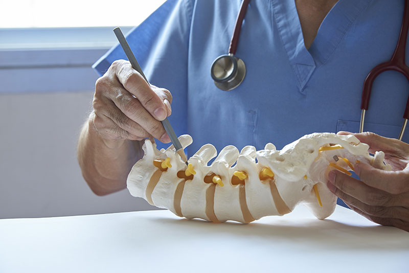 Behandlung bei Morbus Bechterew: Operation Behandlung bei Morbus Bechterew: Operation