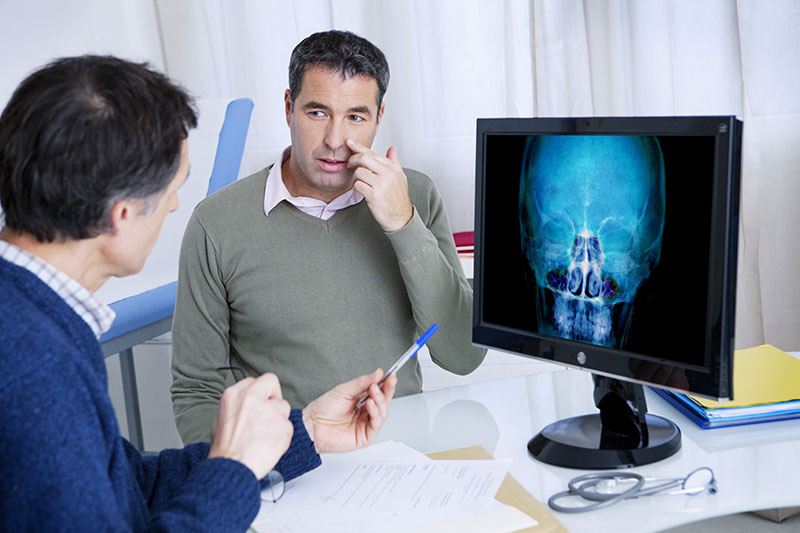 Diagnose chronische Sinusitis Diagnose chronische Sinusitis